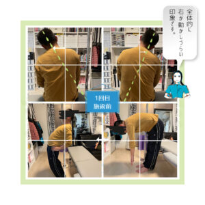 施術前検査と施術後検査