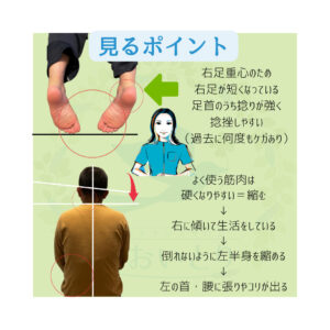 足首の歪みと背骨の歪みの画像