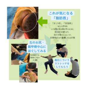 脂肪首とストレッチ、施術の画像